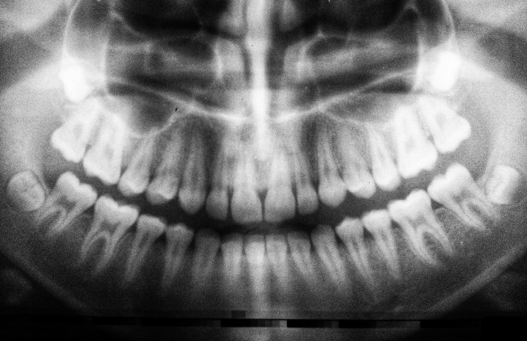 Effect Of Age On Oral Health