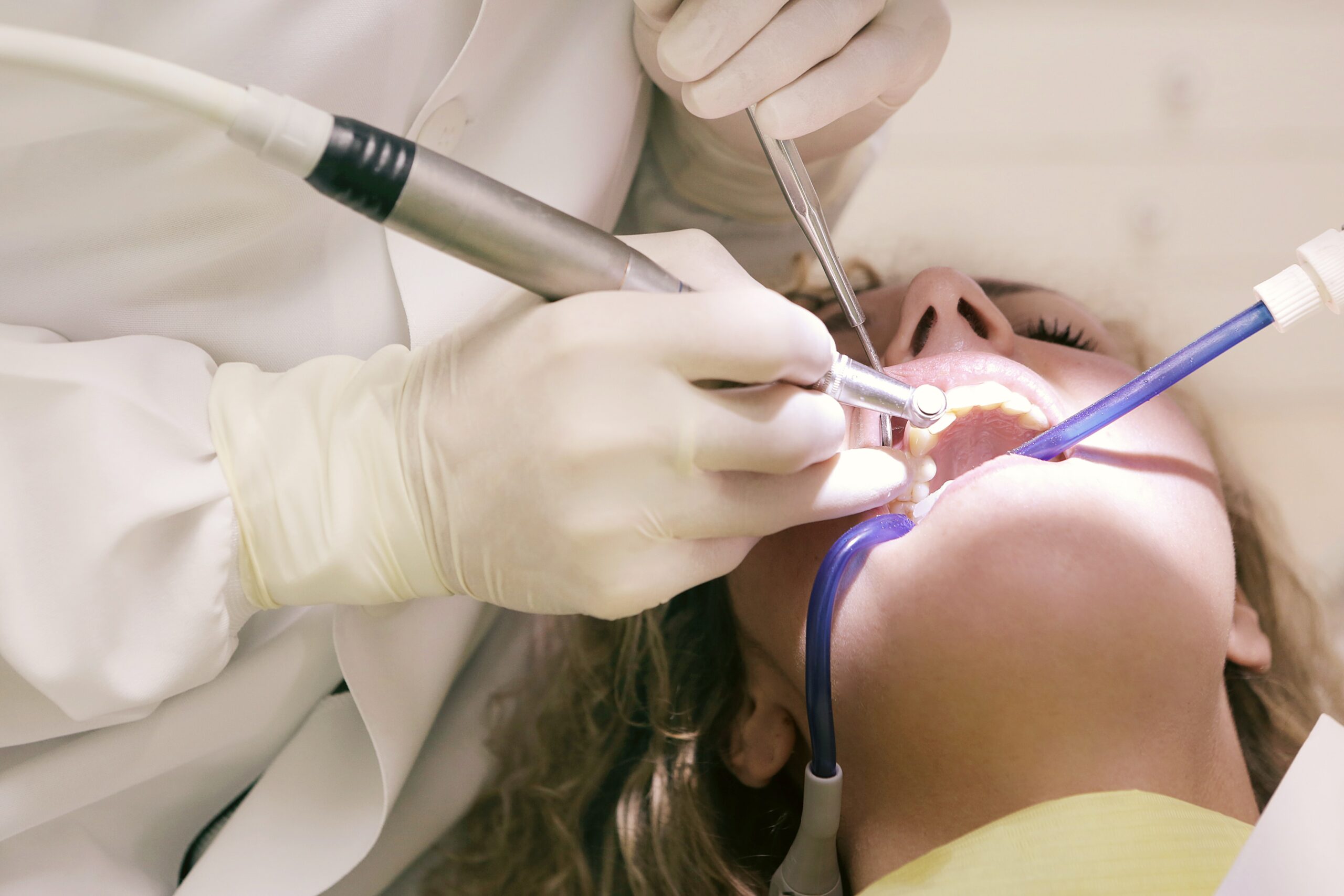 What is the Difference: Teeth Cleaning and Teeth Whitening